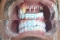 Implant and Oral Surgery