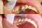 Implant and Oral Surgery