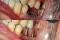 Implant and Oral Surgery