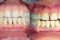 orthodontic