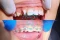 orthodontic